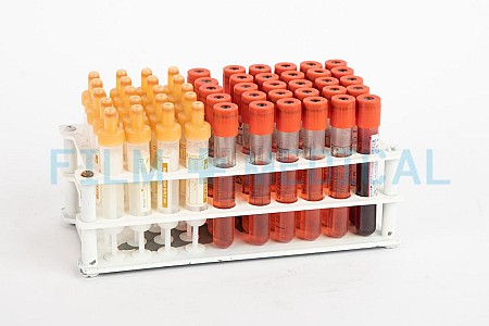 Vacutainers in Rack